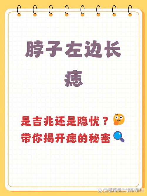 脖子長痣是好是壞  兩側(cè)長痣需平衡工作與家庭
