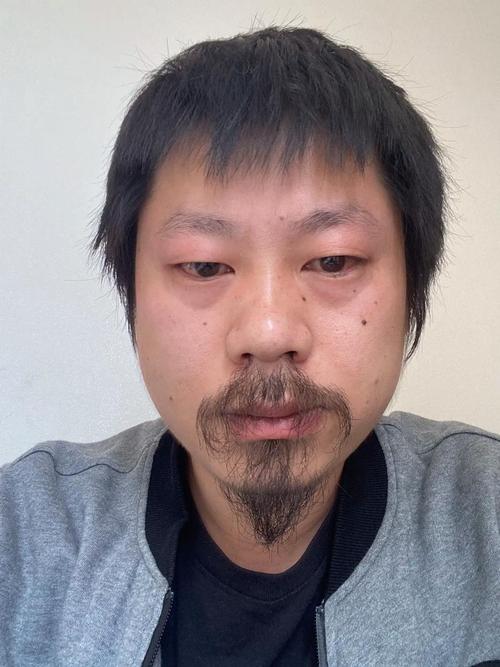 人中沒有胡須的男人命運如何