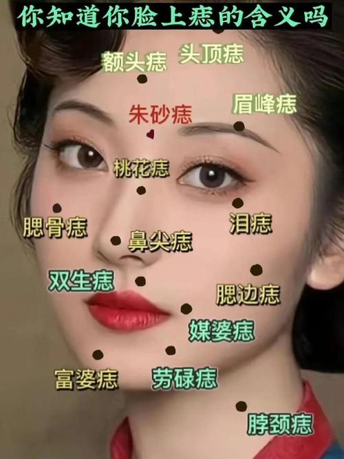 女生左側臉有痣好不好 左顴骨有痣好嗎