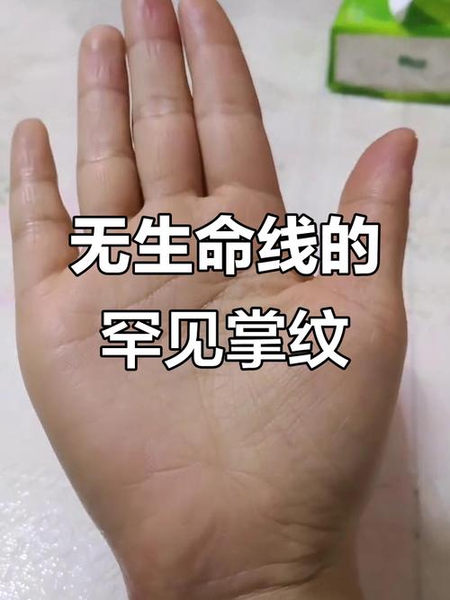 手相沒有生命線，沒有生命線的手相