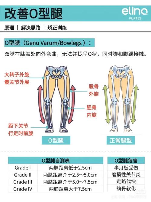 性格內(nèi)向，情路坎坷的O型腿女性面相分析