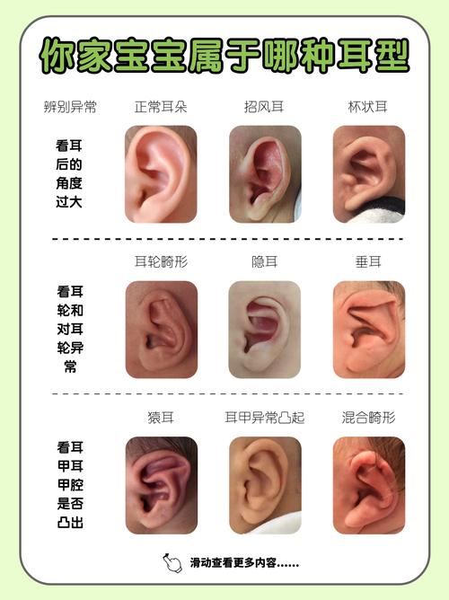 耳朵有幾種類型