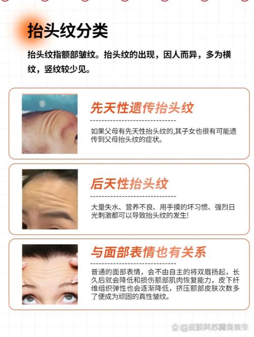 有抬頭紋的人天生就是操勞命嗎