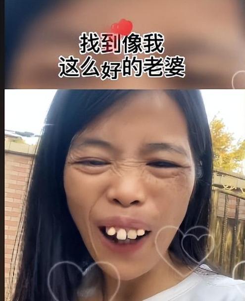女人齙牙不利于婚姻嗎