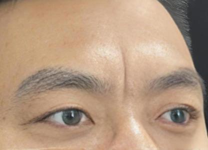 印堂有疤大富大貴的人