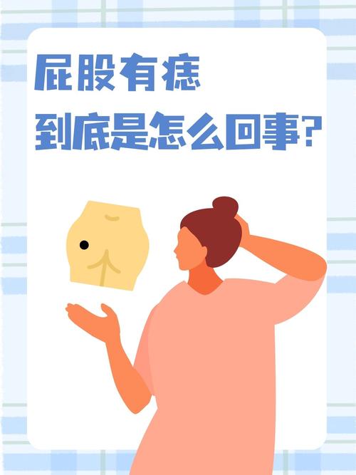 屁股上有痣的人桃花運很旺是真的嗎？