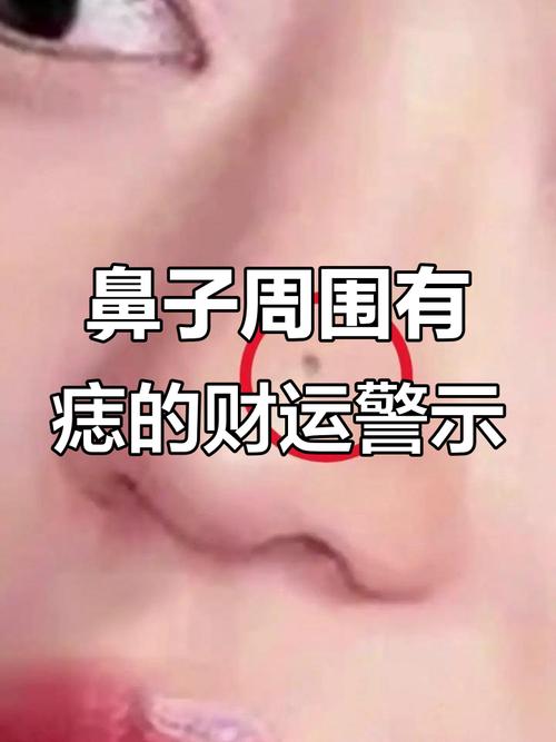 男人鼻子有痣財運不錯，不過理財能力差?