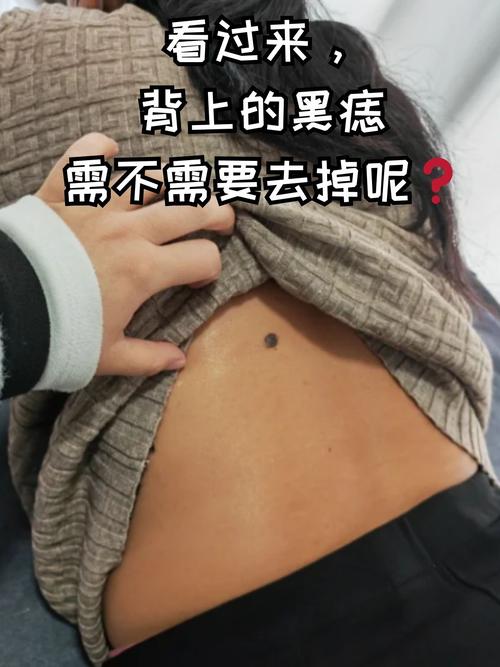 前心后背朱砂痣是什么意思 胸前朱砂痣狡猾心機(jī)重