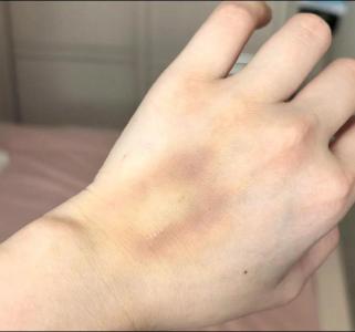 女性手背青筋明顯命苦