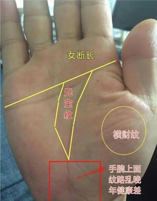 富貴命手相：手腕發(fā)黑且扁是富貴命嗎