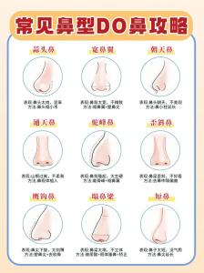 十種鼻型,有那幾種鼻型?