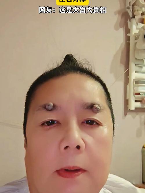 眉毛有痣的人天生富貴，不會為錢所困？