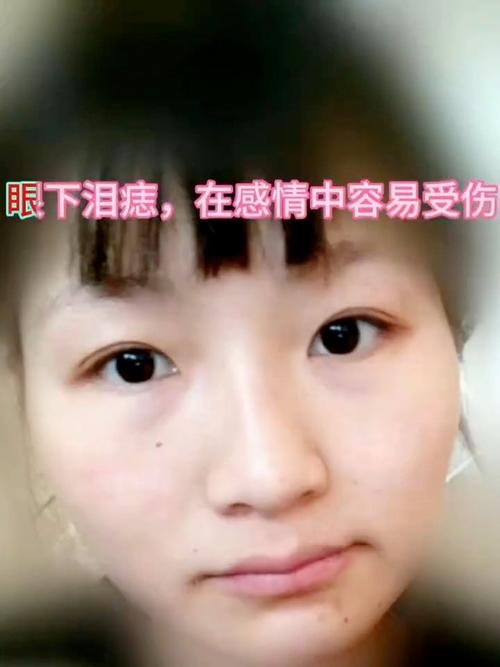女人眼睛下方有痣好不好？為情所困，常常流淚