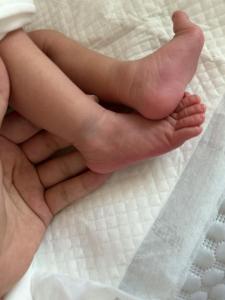 腳上有胎記的人命運如何，民間有什么老說法嗎？