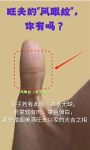 鳳眼紋上方有一個痣是好命嗎 鳳眼紋分析