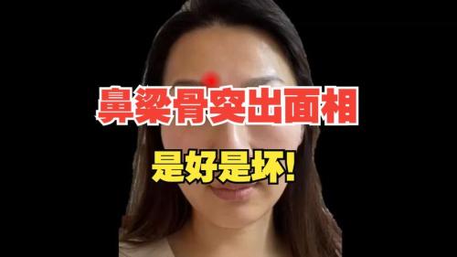 鼻梁骨有個凸起的骨頭,鼻梁骨凸起面相會離婚嗎