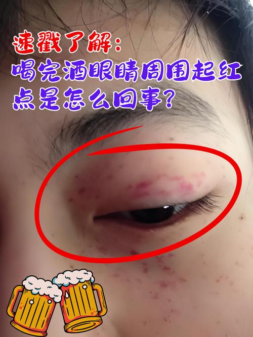 眼睛周圍有紅暈桃花眼