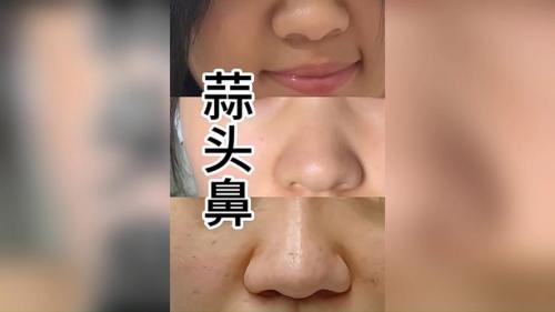 女人鼻孔大的女人財運