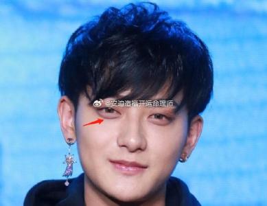 男人眼袋上面長(zhǎng)痣好嗎，能去掉嗎