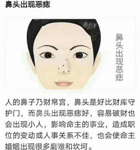 鼻翼右側有痣的女人旺夫是真的嗎？