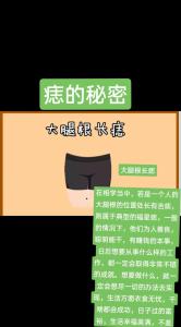 大腿根有痣的女人代表什么，生活幸福美滿？