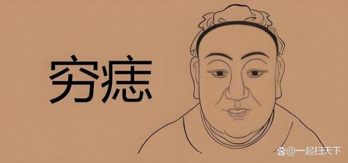 窮痣長在哪里 長痣在哪里最窮