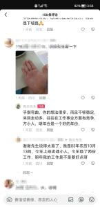 手指截空會(huì)貧窮嗎 要怎么辦