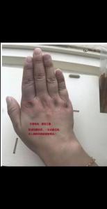 手背厚的人是否值得信賴