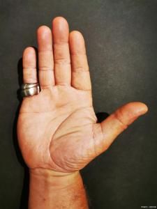 跟斷掌的男人在一起會(huì)倒霉嗎 性格暴躁 婚姻不順