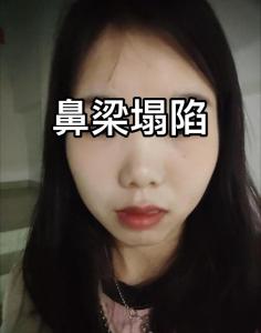 塌鼻梁的女人揮霍無度，命不好是真的嗎？