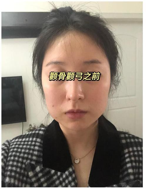 顴骨比較低的人為什么始終存不下錢來呢