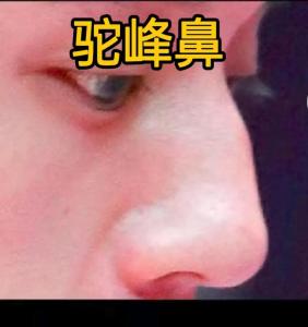 男子鼻子起節代表什么，男子鼻子起節代表有財嗎