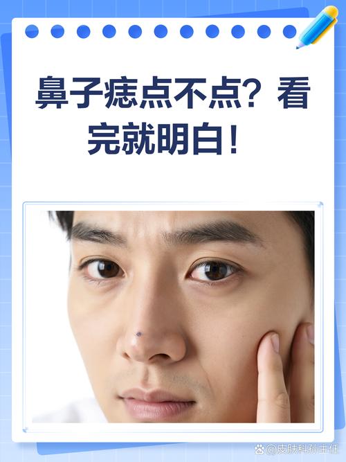男人鼻尖有痣好不好？屬于典型的月光族！