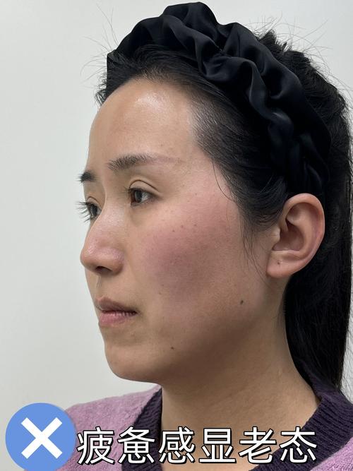 顴骨陷的女人面相