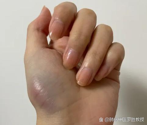 手冒青筋、發(fā)冷的人的性格如何?