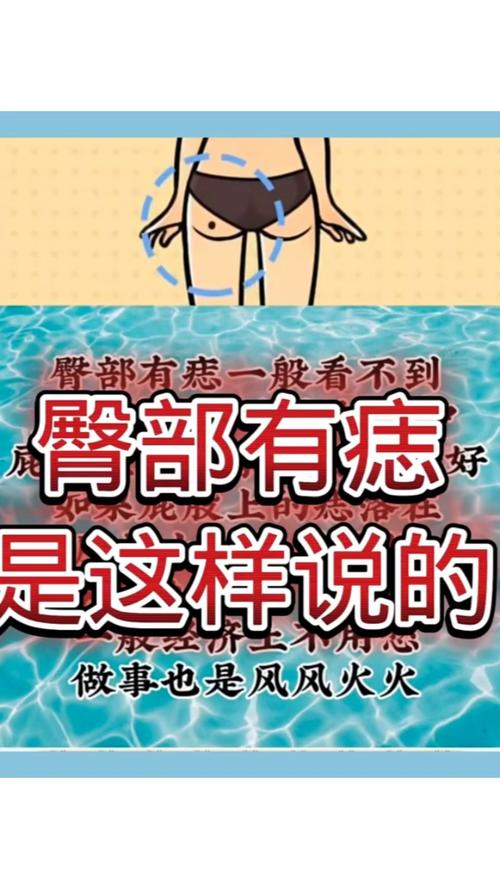 痣相解析臀部上長(zhǎng)痣，意味著什么？