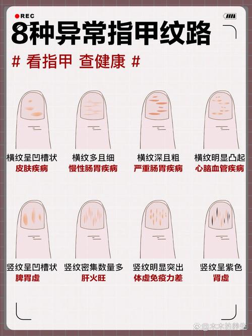 手相知識 手指甲顏色看身體健康
