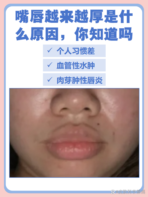 嘴唇厚的人就一定會(huì)為人實(shí)在嗎?