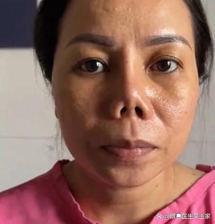 鼻梁有疤女人面相 安于現狀