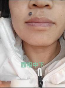麻衣相上唇有痣的女人 食祿運(yùn)頗佳