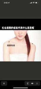 女人左胳膊痣相 左肩膀頭痣暢達痣