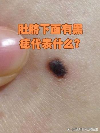 男人肚臍眼下面有痣大多儀表堂堂