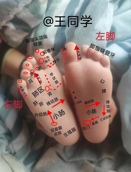 腳底長痣有哪些含義 腳底有痣不同位置長痣痣相分析