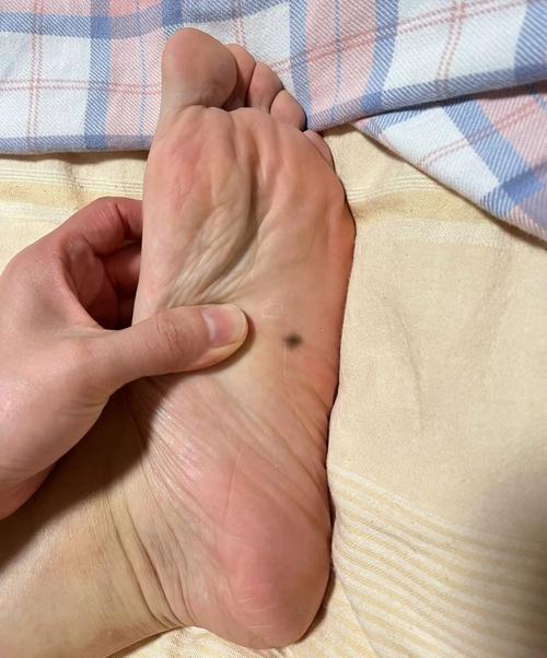 左腳腳底有痣的男人