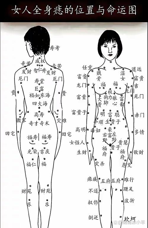 女人左屁股上有痣圖解 需看痣的形態好不好