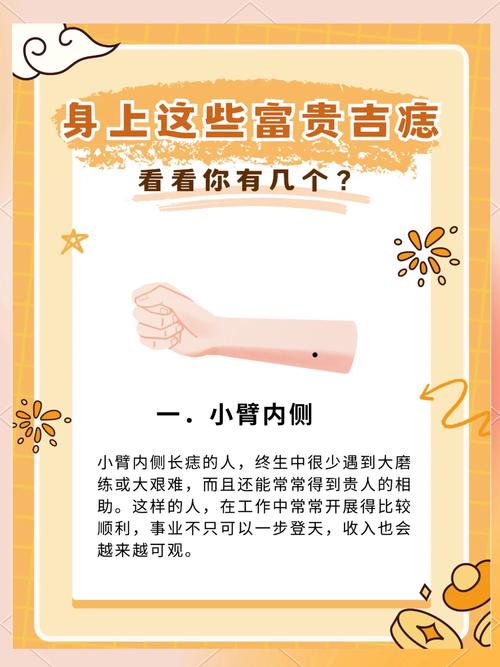 左胳膊有痣有痦子 手臂上的痣代表什么