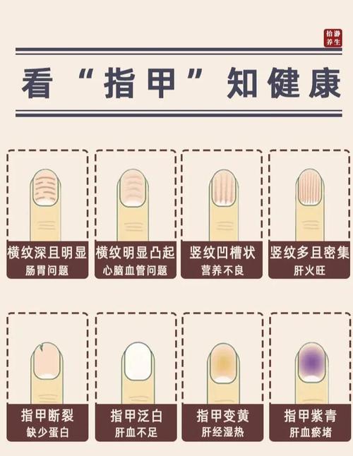 指甲變顏色的寓意