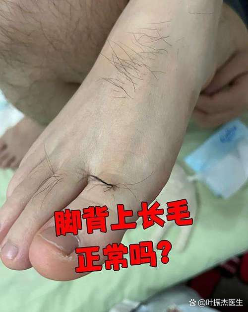 腳背長毛的相學說法 男的腳背長毛代表什么