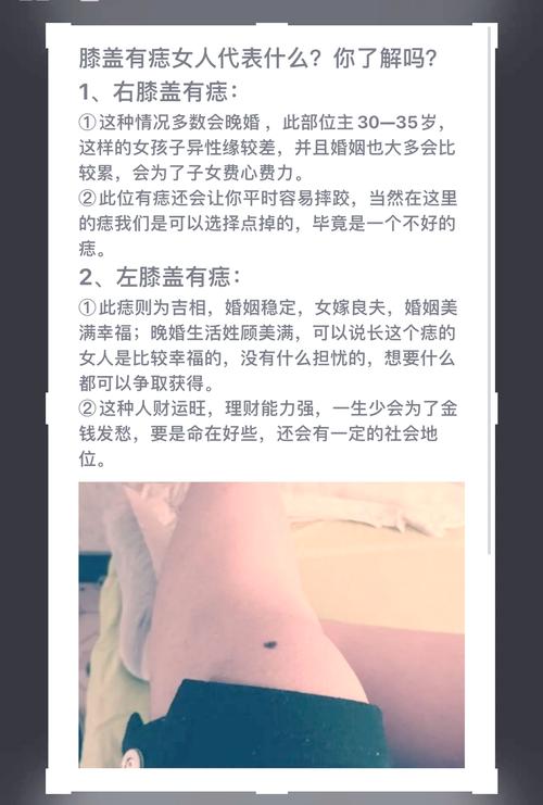 女人膝蓋后窩里長痣好不好 膝蓋上的痣相分析