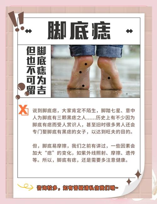 女人的女生腳底心有痣代表什么好不好 女人腳底有痣痣相解析